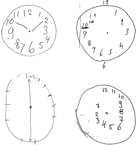 clock drawing test dementia